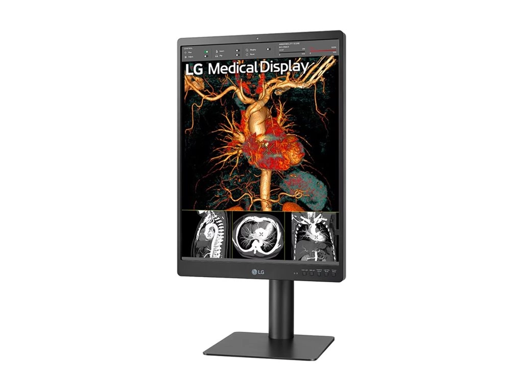 LG 21HQ513D-S - LED monitor - 3MP - color - 21 (21.3" viewable) - 1536 x 2048 @ 60 Hz - IPS - 1100 cd/mï¿½ - 1800:1 - 5 ms -