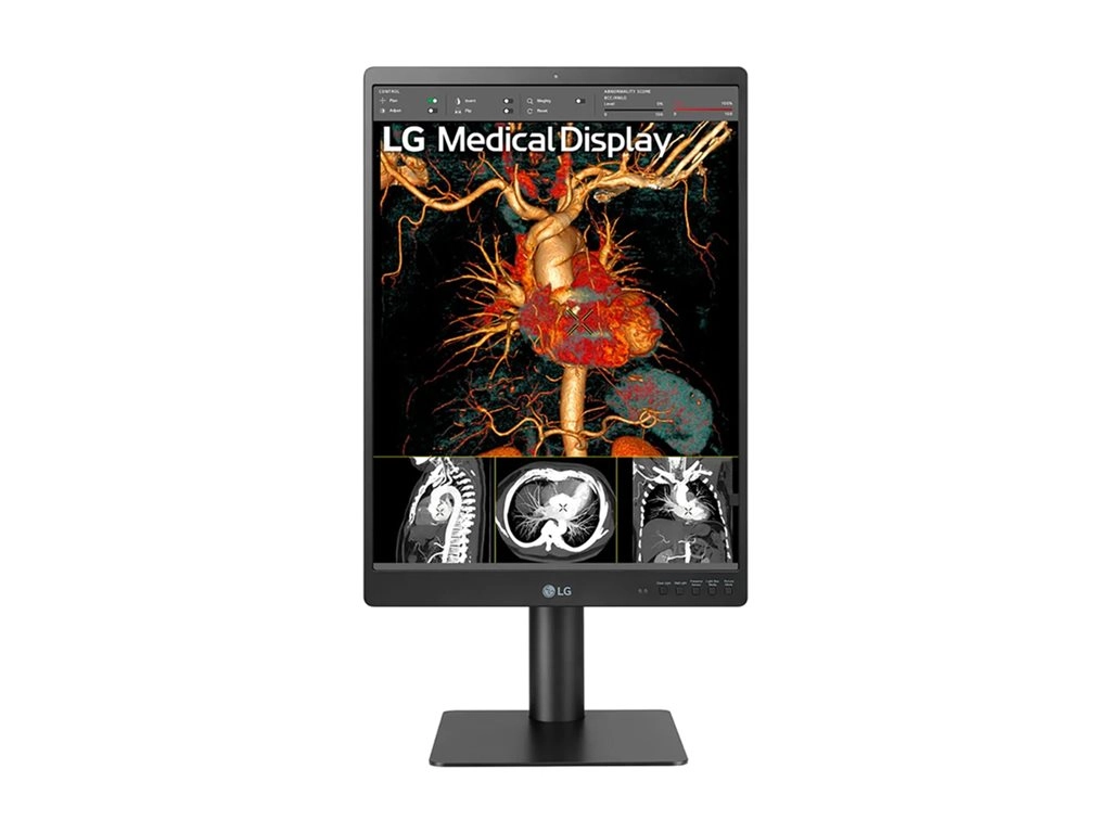 LG 21HQ513D-S - LED monitor - 3MP - color - 21 (21.3" viewable) - 1536 x 2048 @ 60 Hz - IPS - 1100 cd/mï¿½ - 1800:1 - 5 ms -