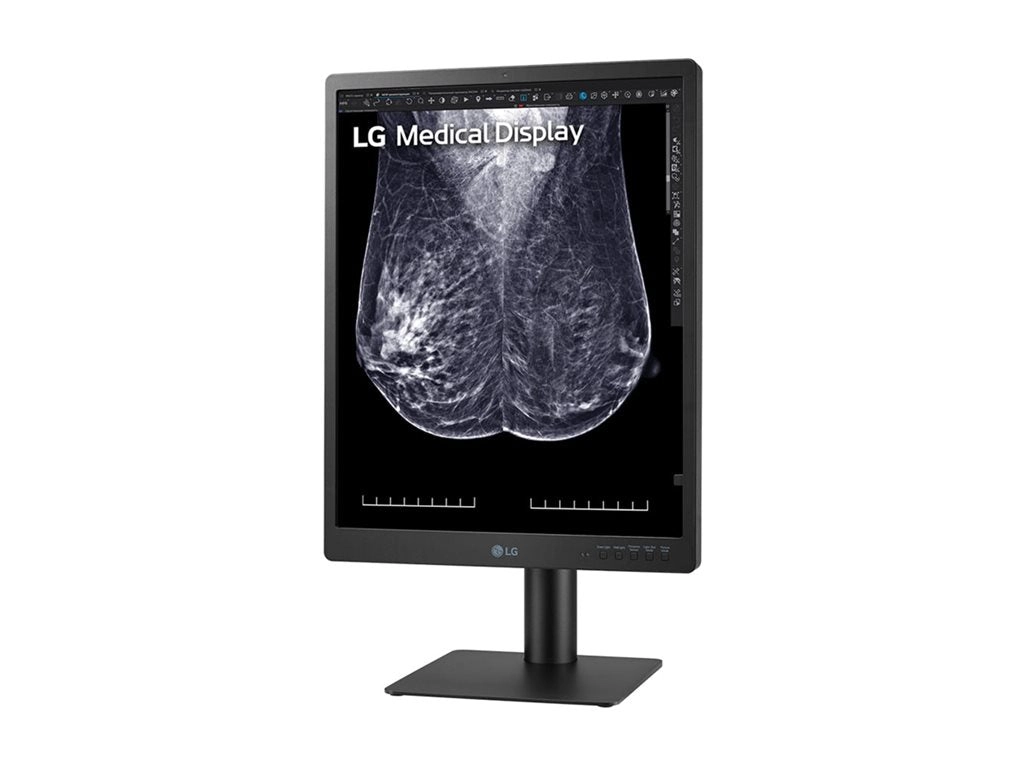 LG 21HQ613D-B - LED monitor - 5MP - color - 21.3 - 2048 x 2560 - IPS - 1100 cd/mï¿½ - 1800:1 - 5 ms - 2xDVI-D